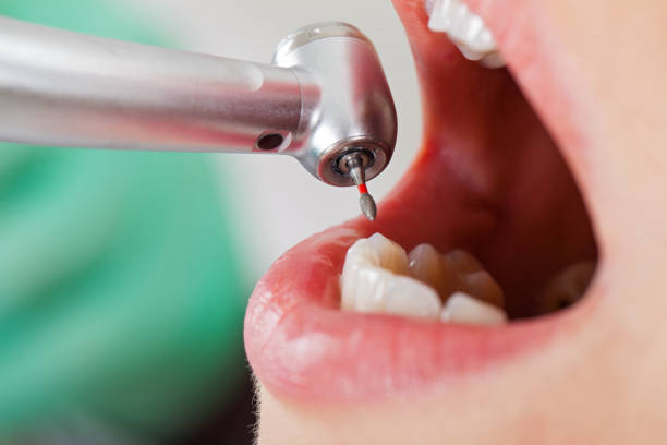 Best After-Hours Emergency Dentist in Elk Grove Vlage, IL